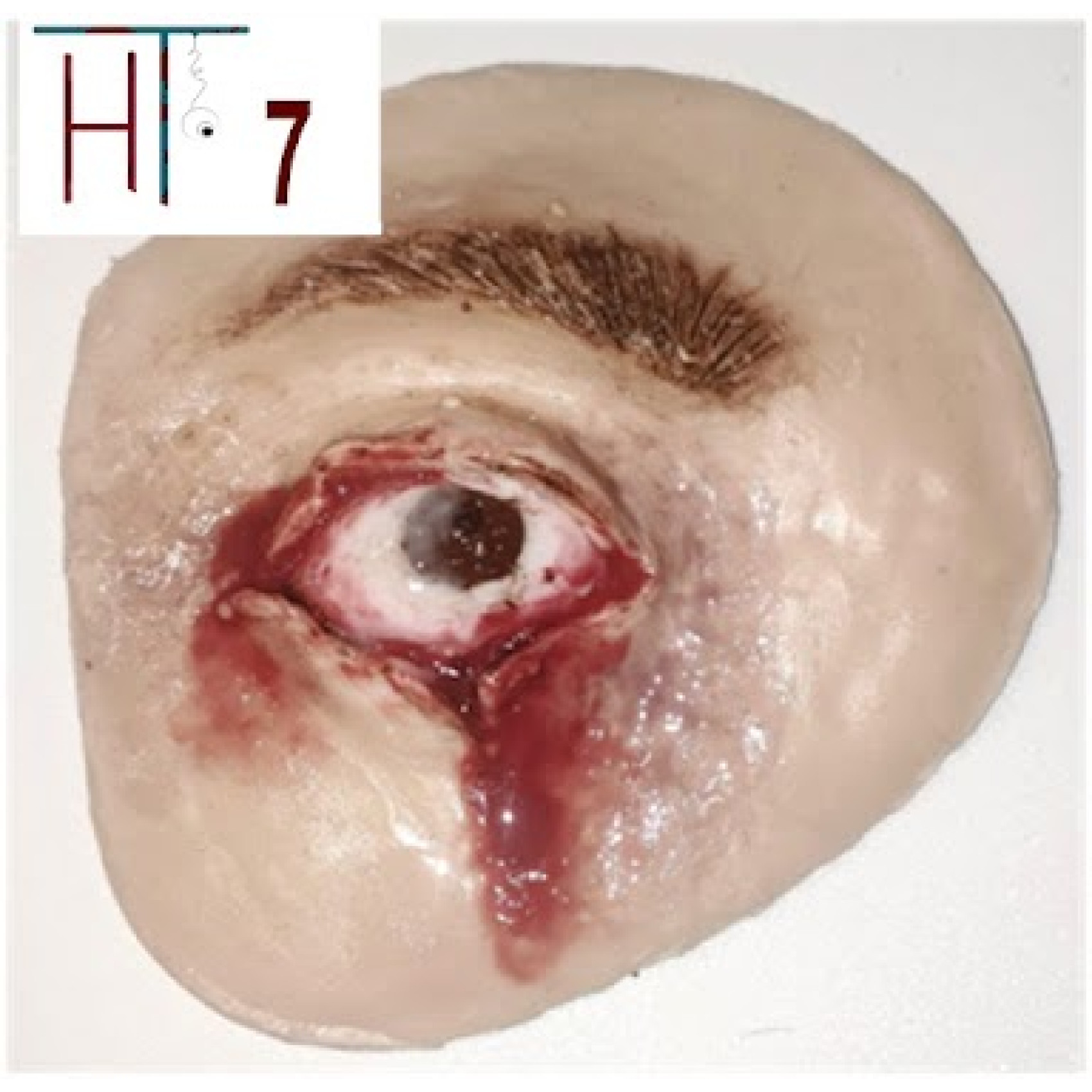 trenuvalna-nakladka-poranennia-oka-1-1700x1700-1.jpg Training pad – eye injury - Image 1